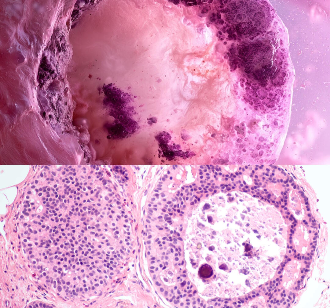 Specimen 076, Ductal Frontier: a pink and violet cinematic tissue landscape paired with an H&E-stained microscopic image of human breast tissue.
